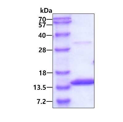 SDS-PAGE: Recombinant Human Myotrophin His Protein [NBP1-50837]